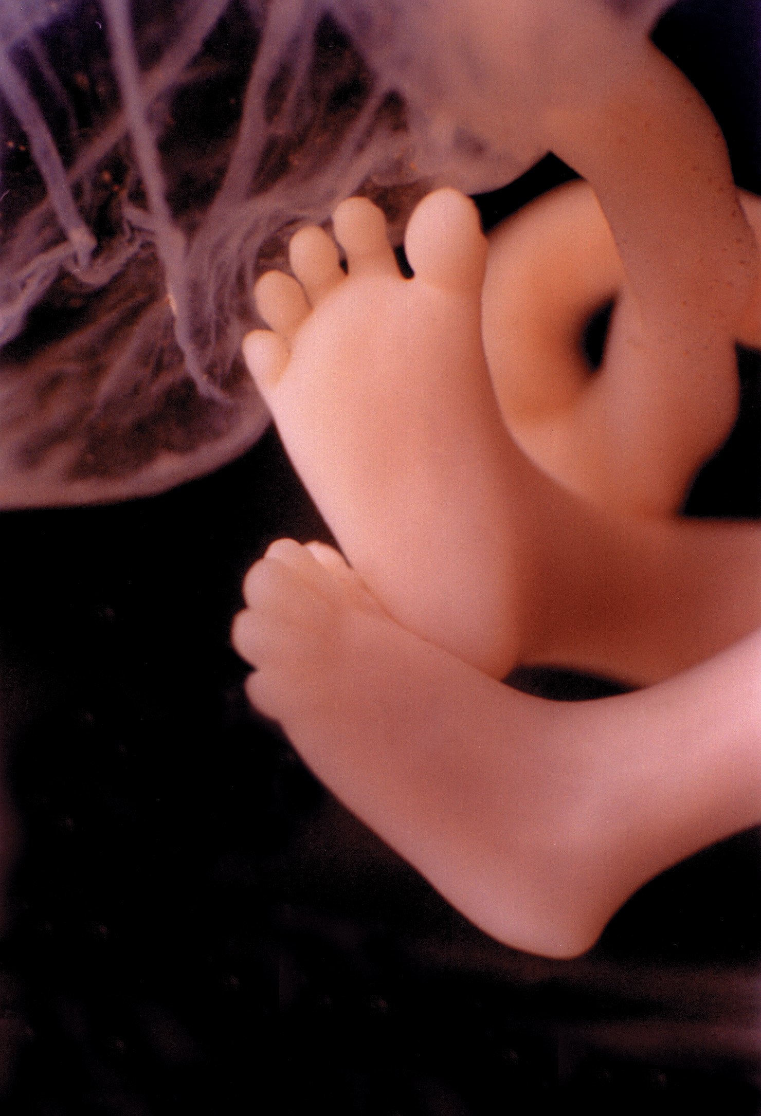 Плод 11 недель фото. Эмбрион на 11 неделе беременности. 11 Недель беременности.
